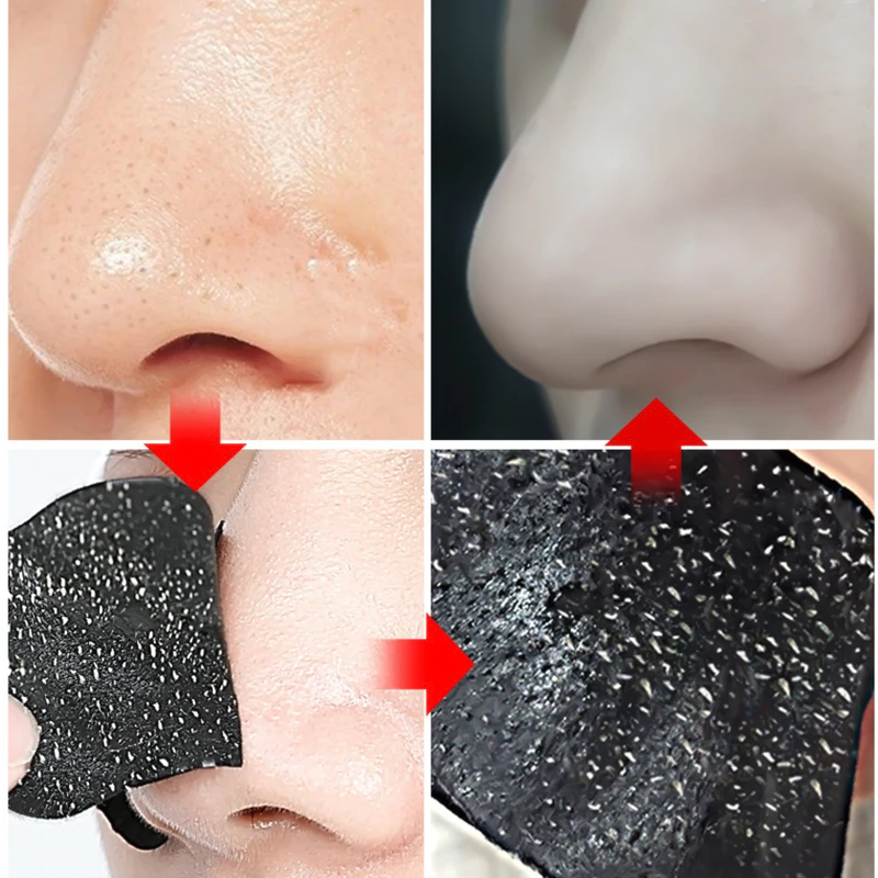 NOSE STRIPS FOR BLACKHEADS, ACNE REMOVAL INSTANT PORE UNCLOGGING - Image 3